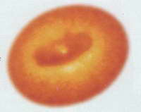 black holes